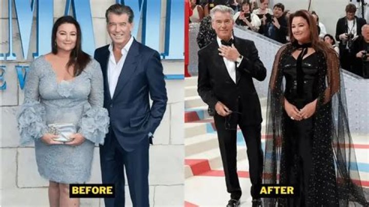 Anna Shay Weight Loss Journey: What Was Wrong With Her Teeth?