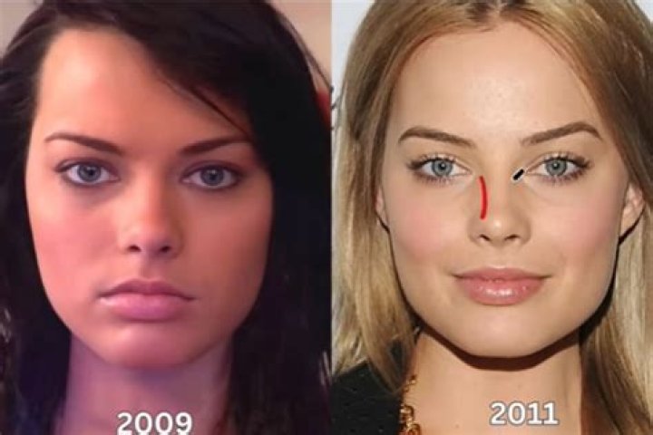 Billie Lee Before And After | Did She Have Surgery