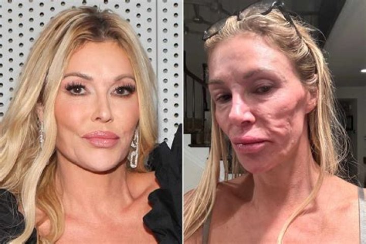 Brandi Glanville Expresses Intentions for Future Plastic Surgery Procedures