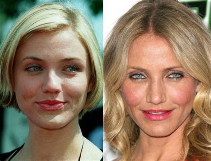 Cameron Diaz Destroyed By Cosmetic Surgery Gone Wild (Photo)