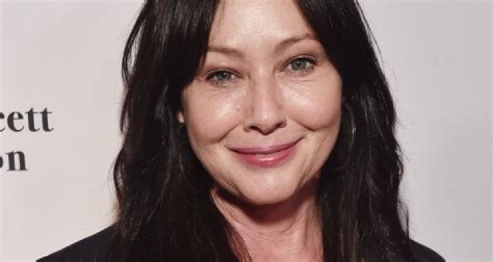 Does Dolly Parton Wear Dentures | False Teeth Before And After