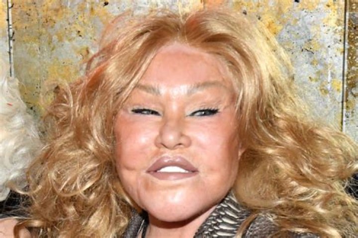 Fame | Jocelyn Wildenstein net worth and salary income estimation Jan, 2024