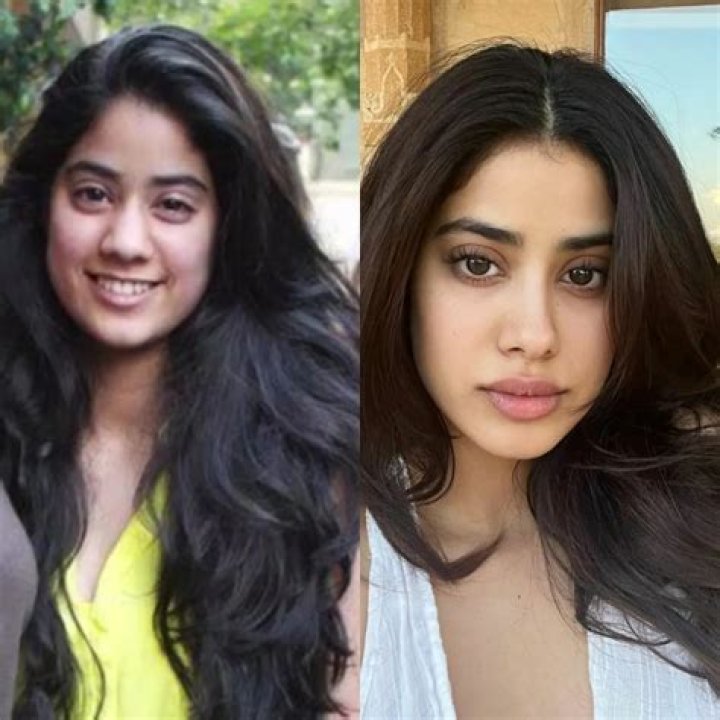 Hajia Bintu Surgery, Before And After