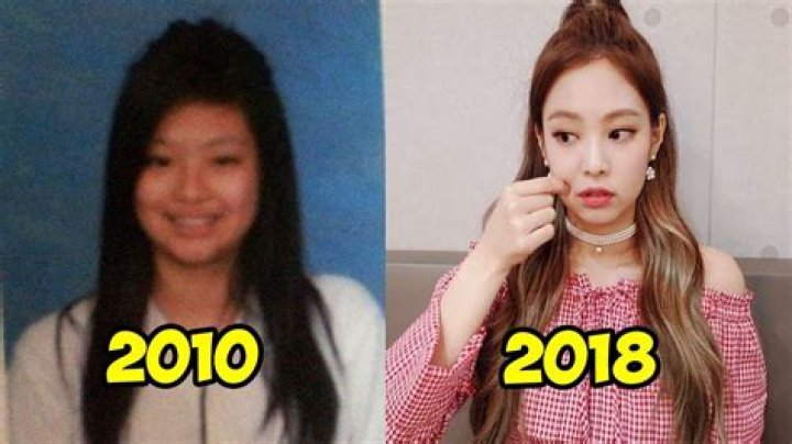 Jennie Kim | Plastic Surgery | Before And After