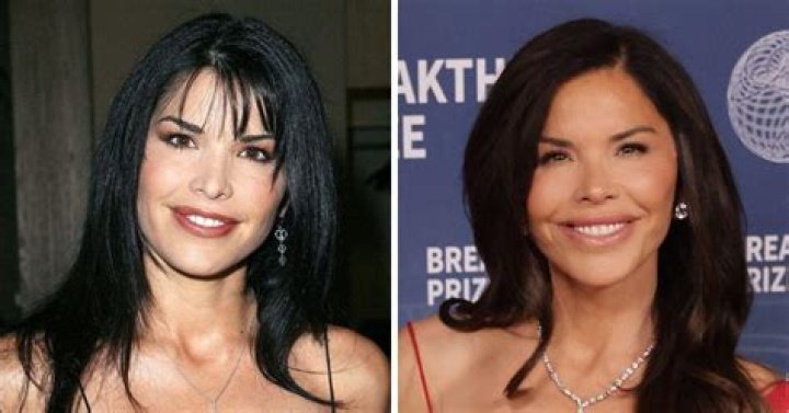 Journalist Heidi Przybyla Plastic Surgery: Before And After Photos