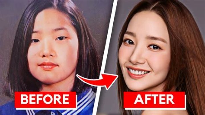 Kim Hieora | Done Plastic Surgery? Before And After Photo
