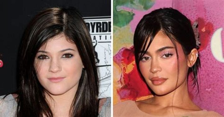 Kylie Jenner’s Plastic Surgery Out Of Control: Momager Kris Jenner Trying To Stop KUWTK Teen Before She Ruins Her Body