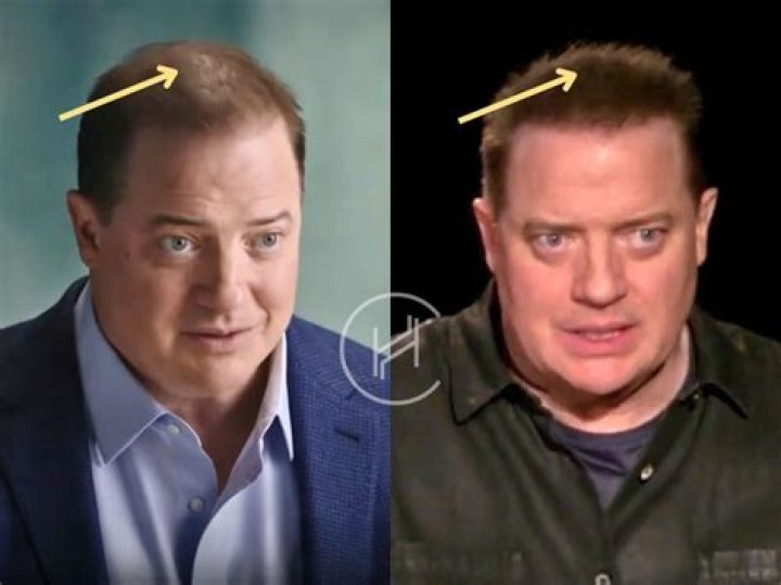 Meet Brendan Fraser’s New Hair