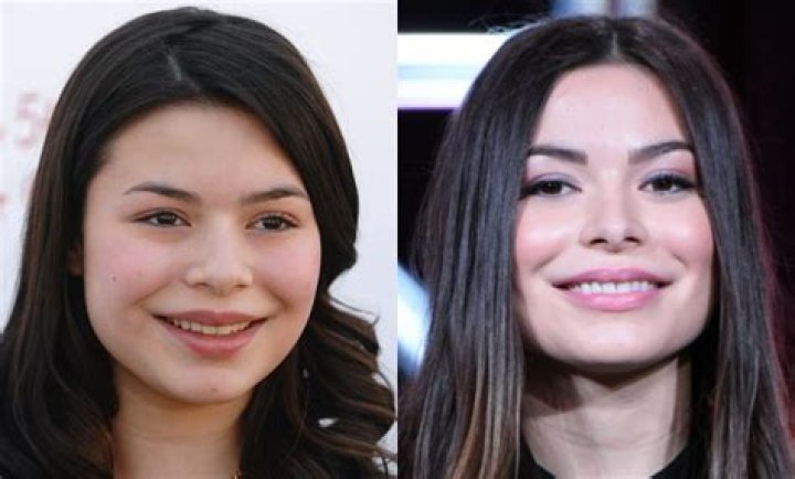 Miranda Cosgrove Plastic Surgery Before and After