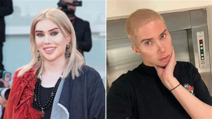 Oli London Wikipedia: Age, Height, Weight, Instagram, Before & After Plastic Surgery