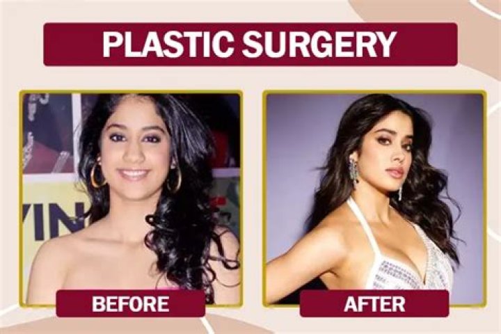 Photos Of Janhvi Kapoor PriorTo Plastic Surgery: Did She Get A Nose Job