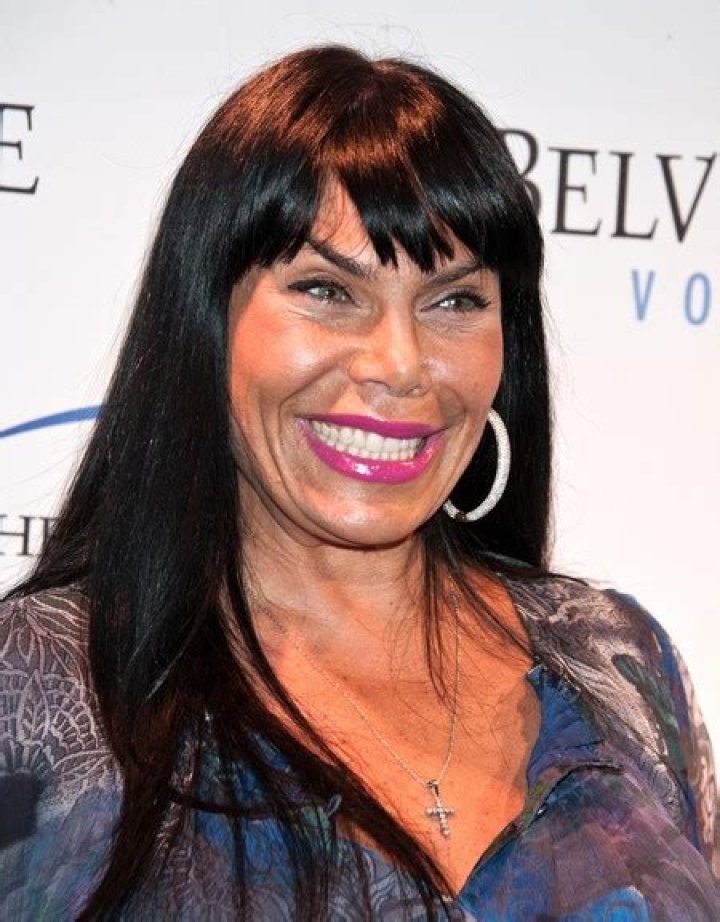Plastic Surgeon Who Hacked Up Renee Graziano Now Suing Her For Complaining (Photo)
