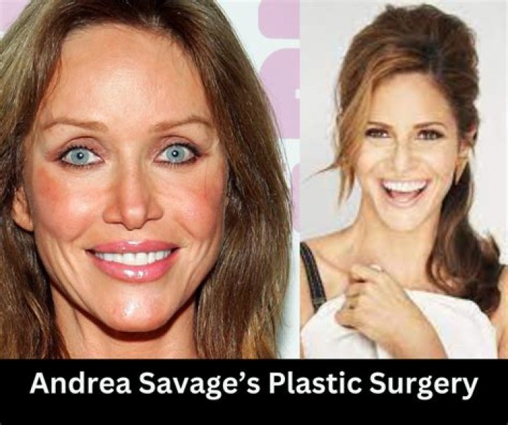 What Did Andrea Savage Do After Her Plastic Surgery? Image Comparison