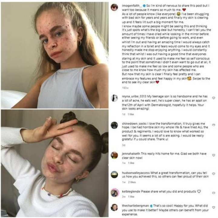 Who is Imogen Heap Dating – Imogen Heap's Boyfriend & Exes